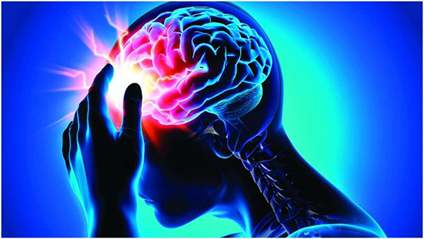 Tai biến mạch máu não, gây đột quỵ: Hệ quả và cách khắc phục