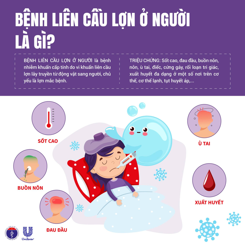 CHỦ ĐỘNG PHÒNG CHỐNG BỆNH LIÊN CẦU LỢN 