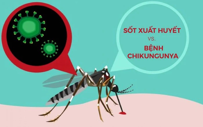 7 ĐIỂM KHÁC BIỆT GIỮA BỆNH CHIKUNGUNYA VÀ SỐT XUẤT HUYẾT