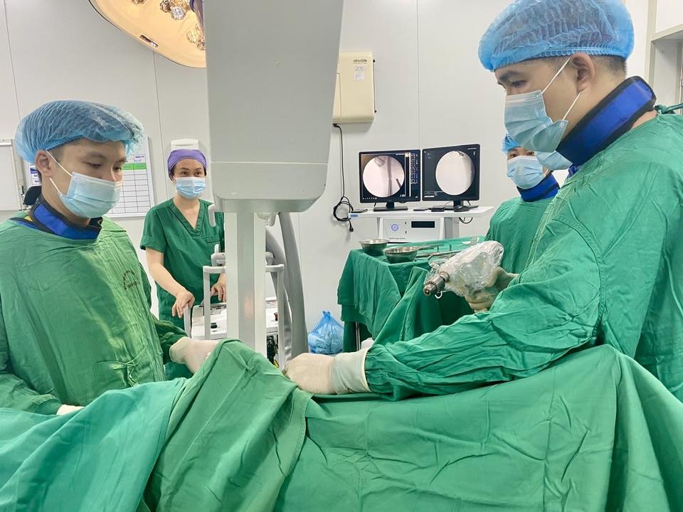 TRIỂN KHAI THÀNH CÔNG PHẪU THUẬT XÂM LẤN TỐI THIỂU ĐIỀU TRỊ GÃY XƯƠNG ĐÙI TRẺ EM